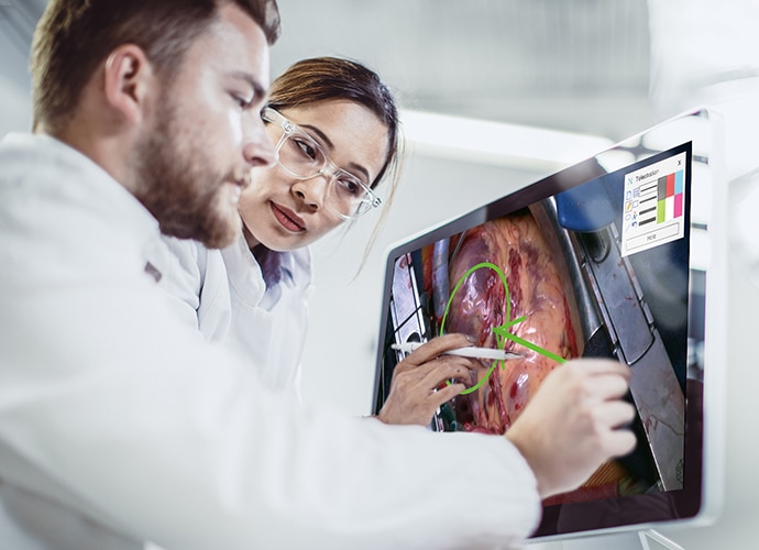 Doctors looking at an endoscopy image on a desktop annoted by a free hand drawn green circle to highlight a particular area on the image