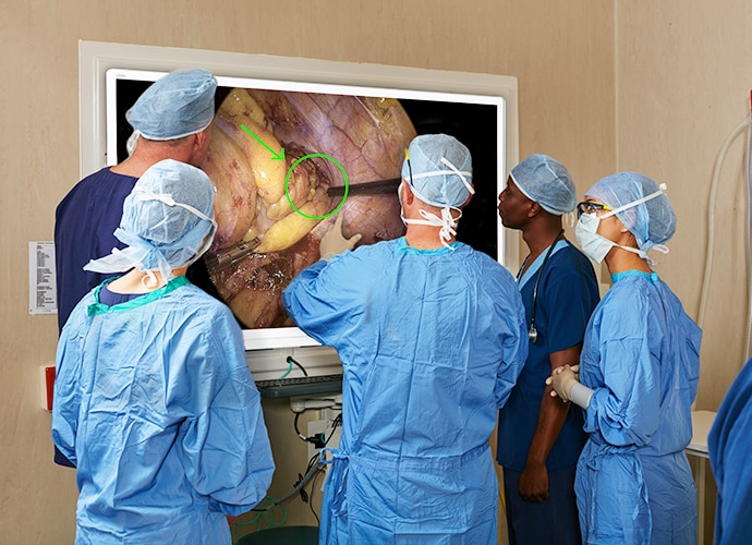 Doctors crowded around a wall mounted television looking at an annoted surgical image