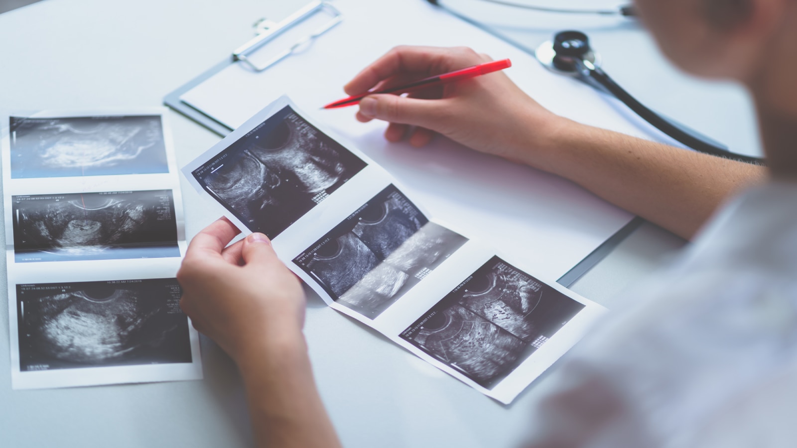 A doctor is checking print images