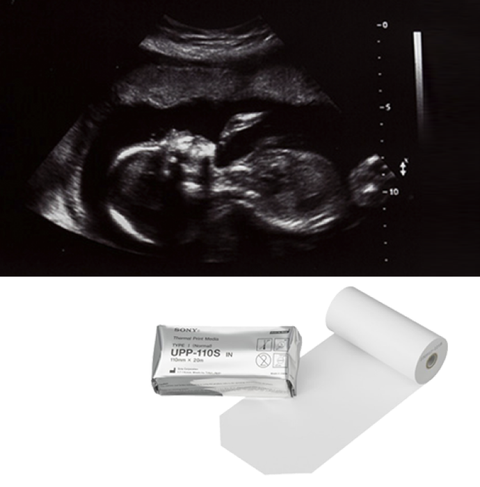 An ultrasound image done with standard printing paper