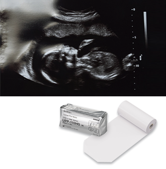 An ultrasound image done with high glossy printing paper