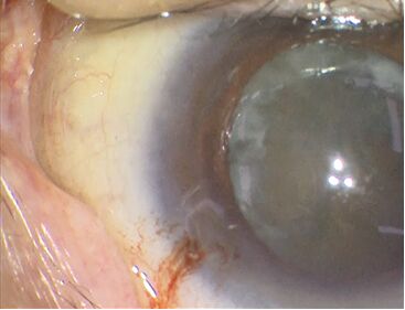 Comparisson surgical image of conventional cameras showing expanded range of light levels