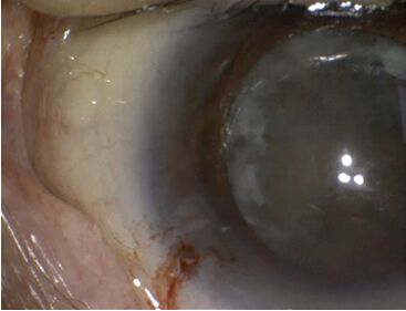 Comparisson surgical images of sony MCC-1000MD showing expanded range of light levels