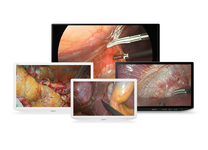 Sony’s 4k 2d and 3d surgical monitors