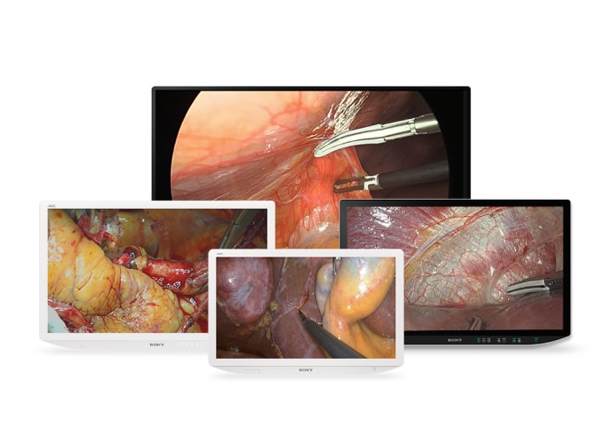 Sony’s surgical monitors on a white background