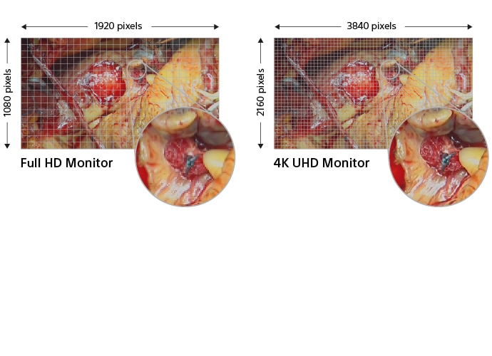 Comparison of 4k and HD image quality