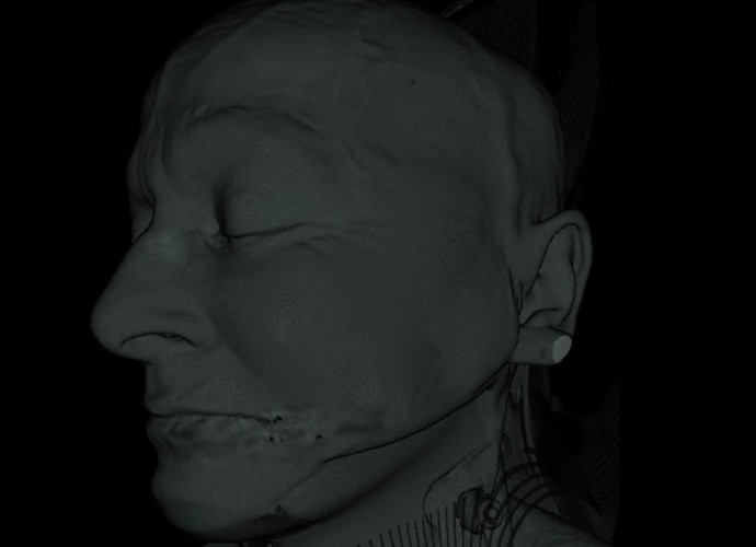 3D Medical imagery