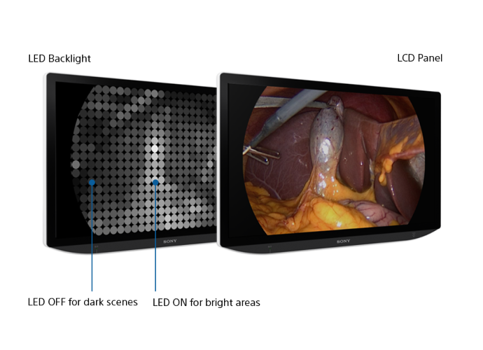 Sony’s medical monitors showing how local diming technology works