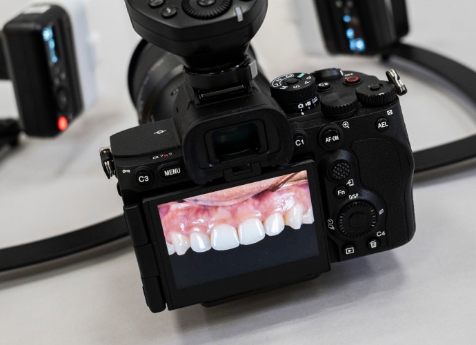 Sony’s camera showing the image of the upper teeth